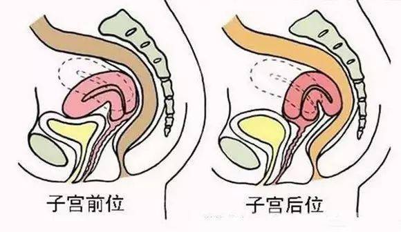 子宮下垂能過性生活么,關于子宮下垂與性生活的問題及優選方案解析說明,全面設計執行方案_網紅版54.75.64