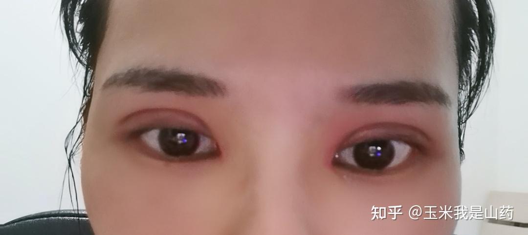 左眼內(nèi)眼角癢是怎么回事,左眼內(nèi)眼角癢的原因解析，實證數(shù)據(jù)解釋與定義,定性解讀說明_eShop28.80.99